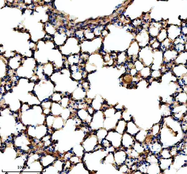 IHC analysis of NEK5 using anti-NEK5 antibody (A14002-3)