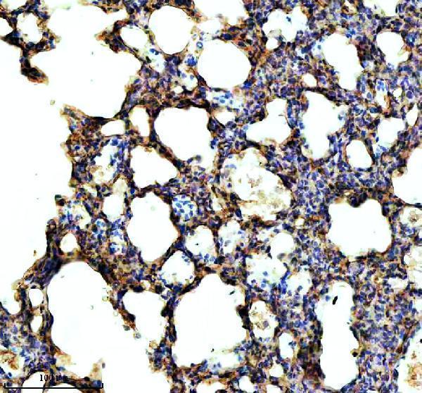 IHC analysis of NEK5 using anti-NEK5 antibody (A14002-3)