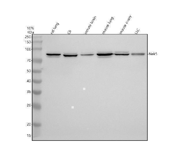Western blot analysis of NEK5 using anti-NEK5 antibody (A14002-3)