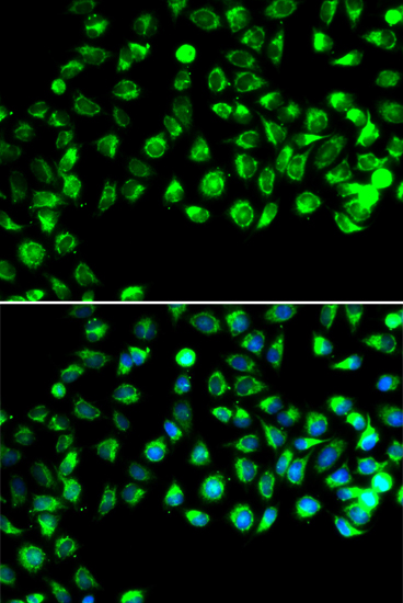a14005 cfap20 primary antiboties if testing 4