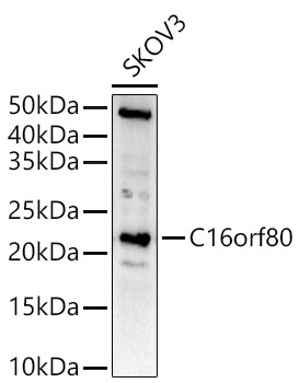Western blot analysis of extracts of SKOV3 cells, using C16orf80 antibody  at  1:1520 dilution