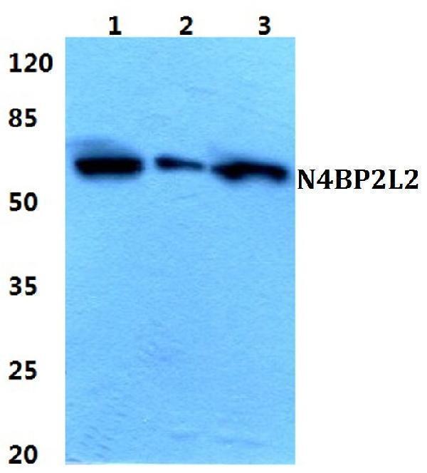 Western blot (WB) analysis of N4BP2L2 polyclonal antibody at 1:500 dilution
Lane1:MCF-7 cell lysate
Lane2:H9C2 cell lysate
Lane3:Rat lung tissue lysate