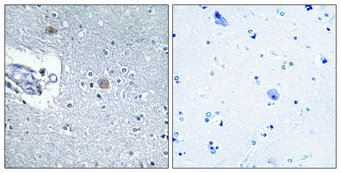 Immunohistochemistry validation of CHPF2 using Anti-CSGlcA-T CHPF2 Antibody (A14020-1)