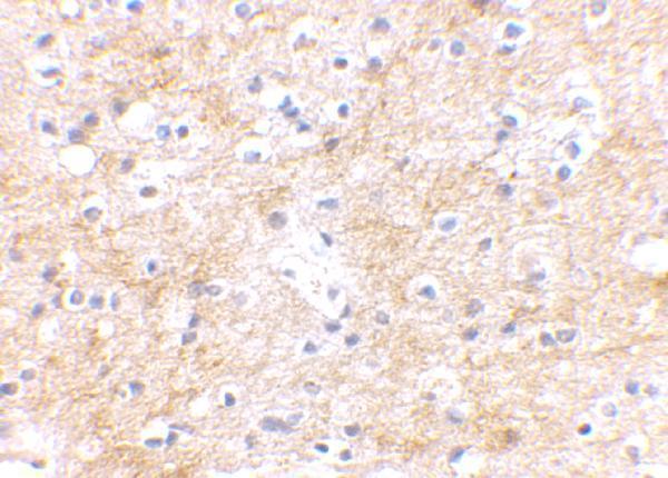 a14041 dlgap3 primary antibodies ihc testing 2