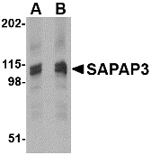 a14041 dlgap3 primary antibodies wb testing 1