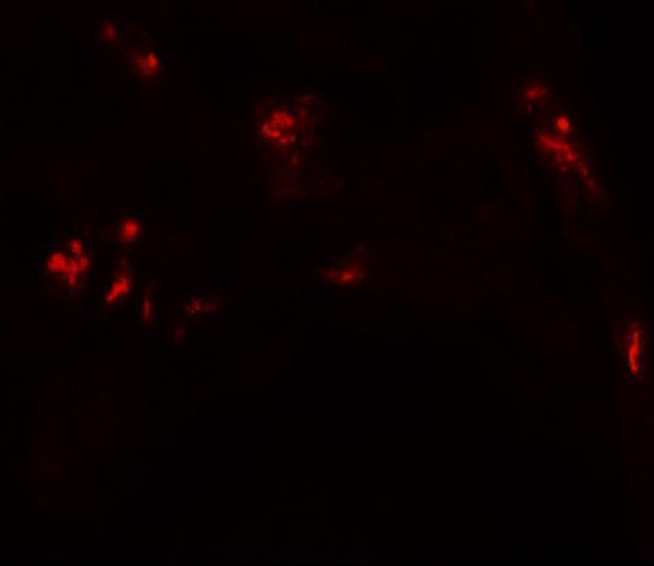 a14046 dbx1 primary antibodies if testing 3
