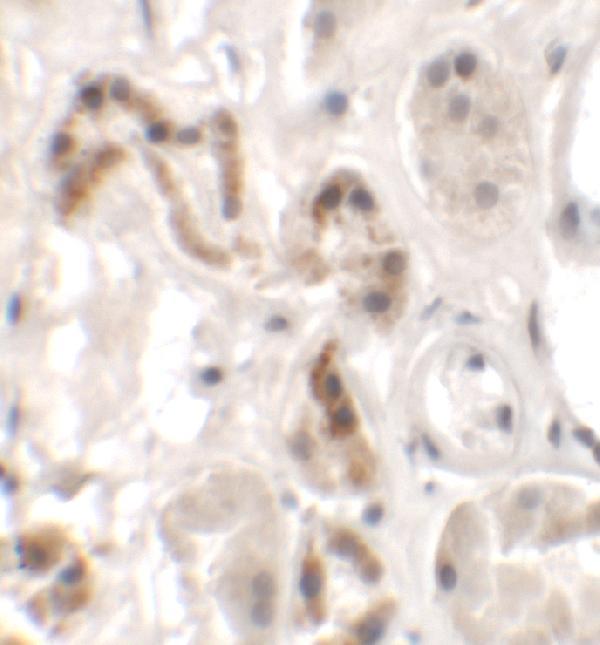 a14046 dbx1 primary antibodies ihc testing 2