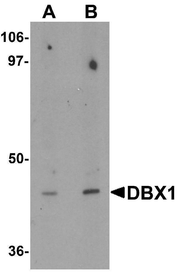 a14046 dbx1 primary antibodies wb testing 1