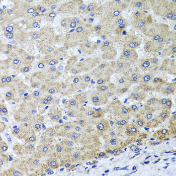 Immunohistochemistry of paraffin-embedded human liver injury using OSGEPL1 antibody at dilution of 1:100 (x40 lens)