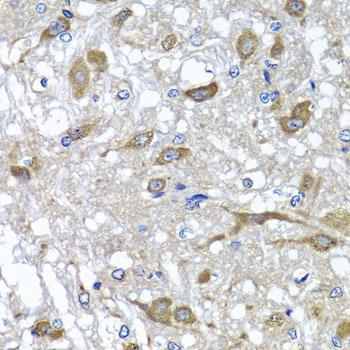 Immunohistochemistry of paraffin-embedded rat brain using OSGEPL1 antibody at dilution of 1:100 (x40 lens)