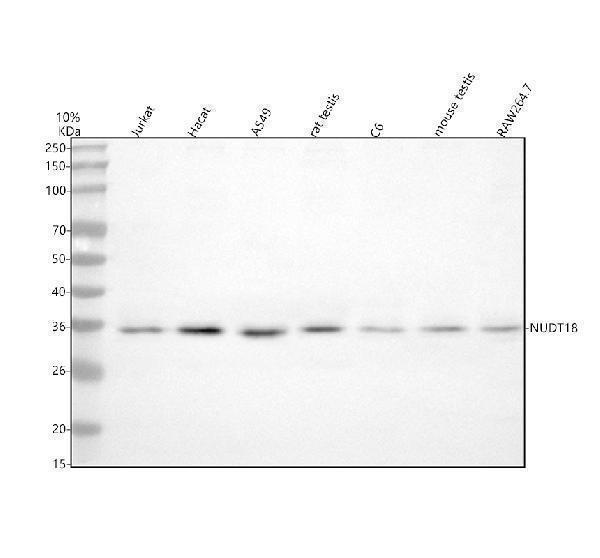  Western blot analysis of NUDT18 using anti-NUDT18 antibody (A14058-2)