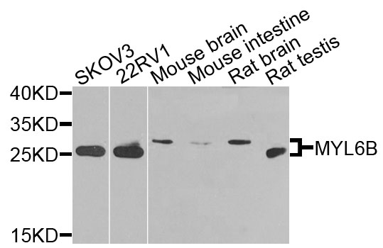 a14059 myl6b primary antiboties wb testing 1