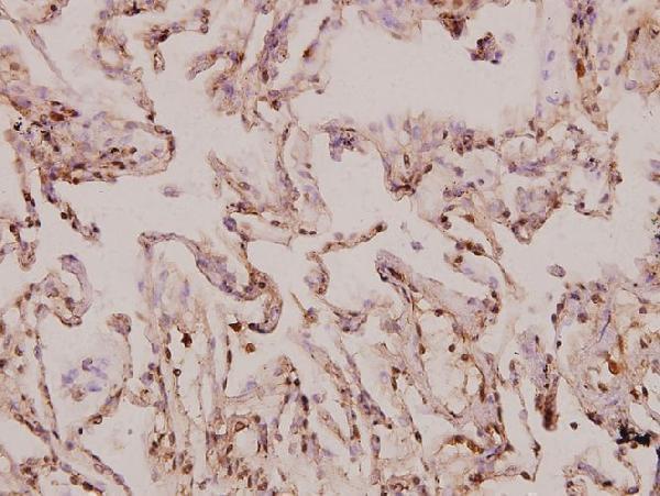 a14072s9 mrps9 primary antiboties ihc testing 2
