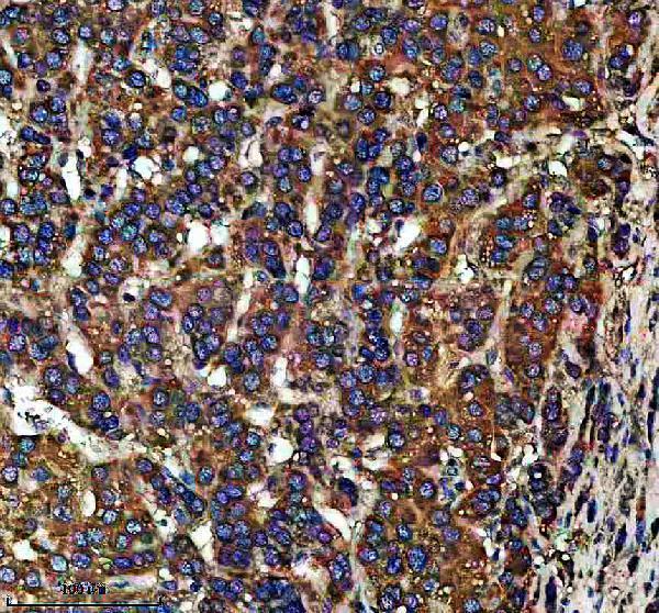 IHC analysis of TTC35/EMC2 using anti-TTC35/EMC2 antibody (A14073-1)