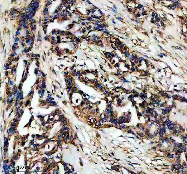 IHC analysis of TTC35/EMC2 using anti-TTC35/EMC2 antibody (A14073-1)