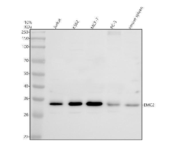 Western blot analysis of TTC35/EMC2 using anti-TTC35/EMC2 antibody (A14073-1)