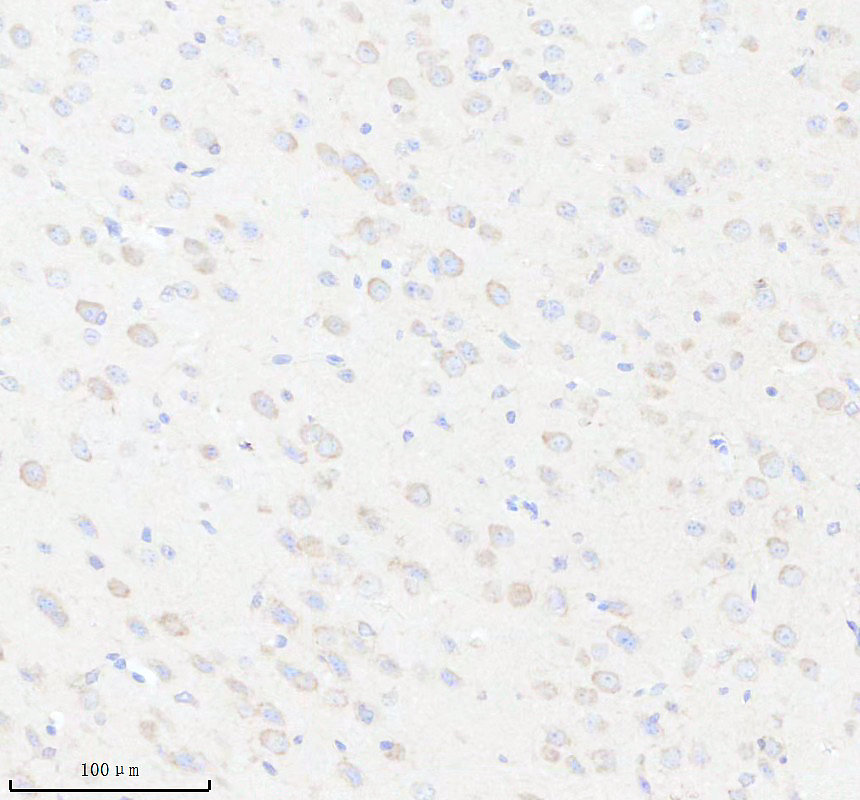 IHC analysis of MRPL15 using anti-MRPL15 antibody (A14077-2)