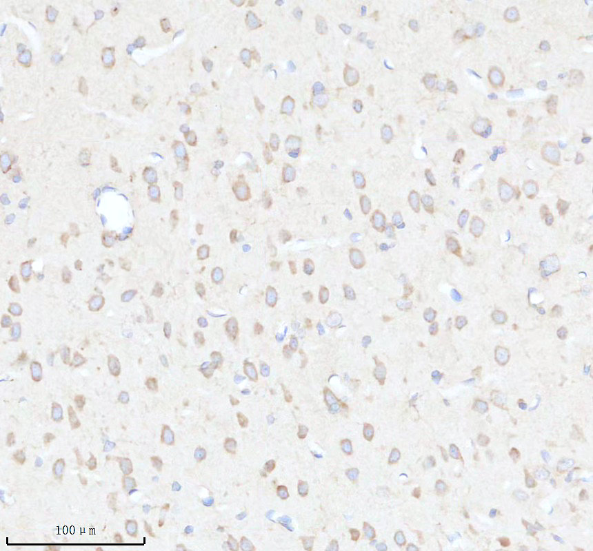 IHC analysis of MRPL15 using anti-MRPL15 antibody (A14077-2)