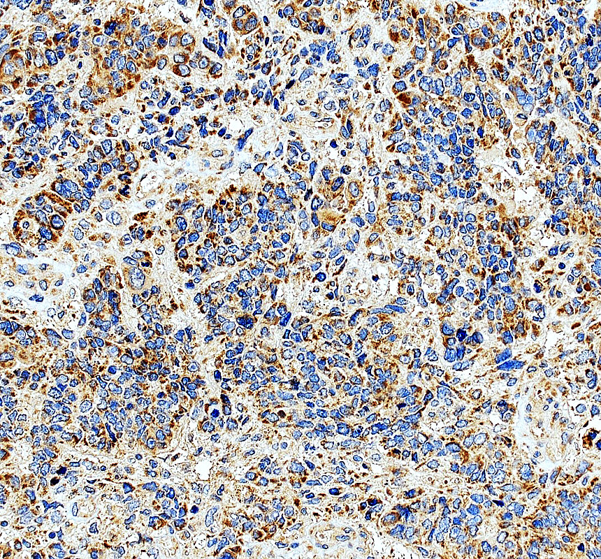 a14077 2 mrpl15 primary antibodies ihc testing 3