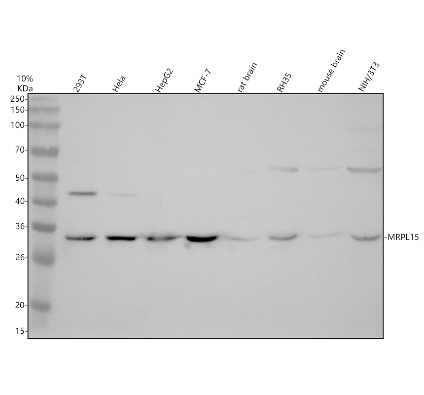 Western blot analysis of MRPL15 using anti-MRPL15 antibody (A14077-2)