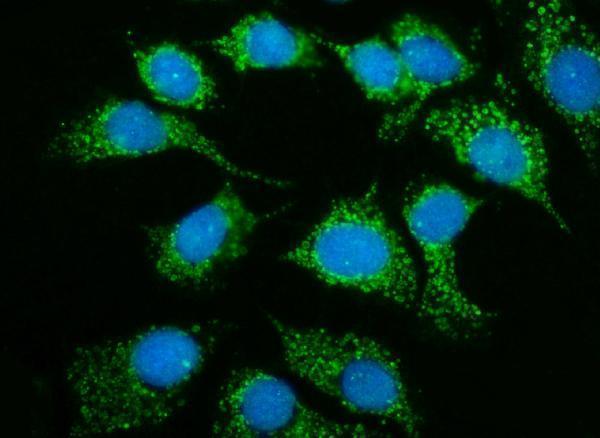 a14080 3 mrps25 primary antibodies if testing 11