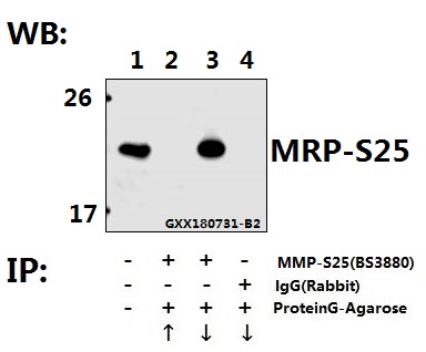 a14080s25 mrps25 primary antiboties ip testing 4