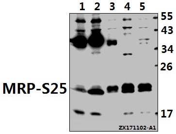 a14080s25 mrps25 primary antiboties wb testing 1
