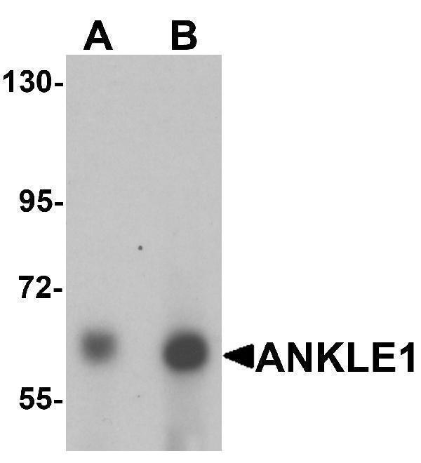 Western blot analysis of ANKLE1 in 293 cell lysate with ANKLE1 antibody at (A) 1 and (B) 2 μg/mL