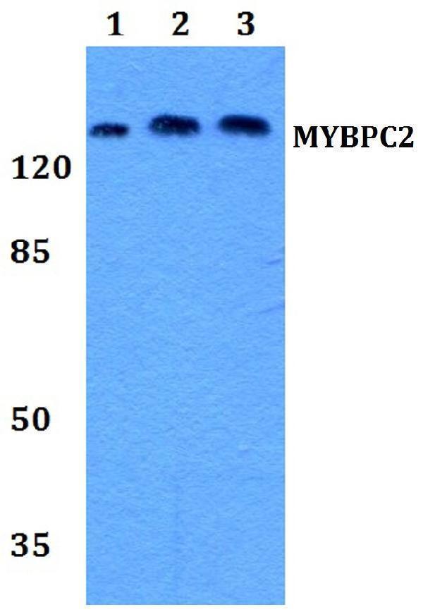 Western blot (WB) analysis of MYBPC2 polyclonal antibody at 1:500 dilution
Lane1:Hela whole cell lysate
Lane2:NIH-3T3 whole cell lysate
Lane3:H9C2 whole cell lysate