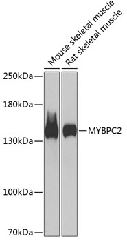 Western blot analysis of extracts of various cell lines, using MYBPC2 antibody  at 1:1000 dilution