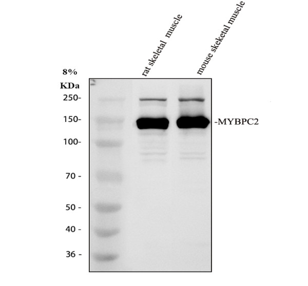 a14099 3 mybpc2 primary antibodies wb testing 1