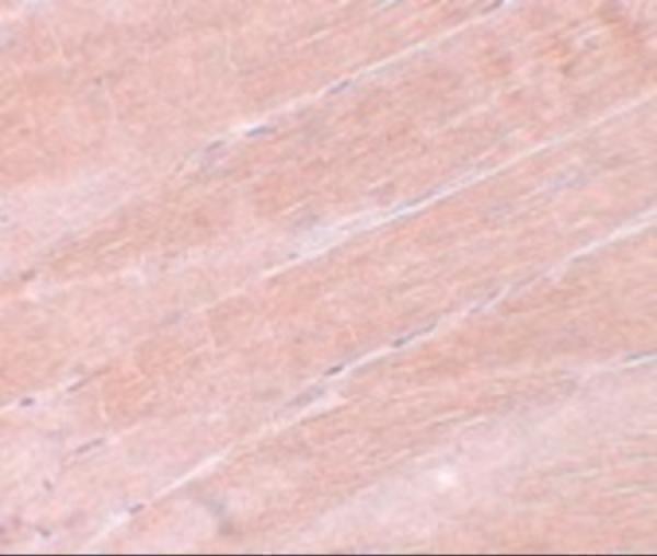 Immunohistochemistry of MYBPC2 in mouse skeletal muscle tissue with MYBPC2 antibody at 5 μg/mL
