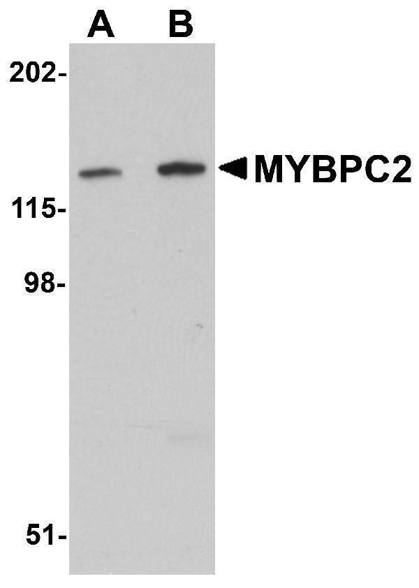 Western blot analysis of MYBPC2 in mouse skeletal muscle tissue lysate with MYBPC2 antibody at (A) 1 and (B) 2 μg/mL