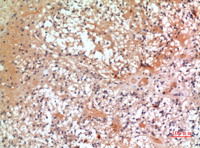 a14107 cmtm6 primary antibodies ihc testing 1