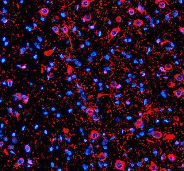 a14108 2 syt10 primary antibodies if testing 1