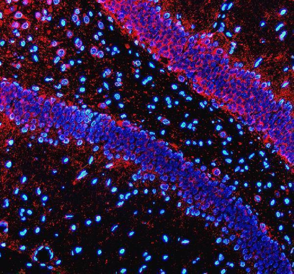 a14108 2 syt10 primary antibodies if testing 2