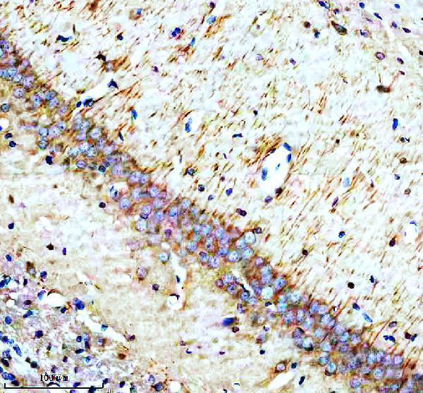 IHC analysis of Synaptotagmin-10/SYT10 using anti-Synaptotagmin-10/SYT10 antibody (A14108-2)