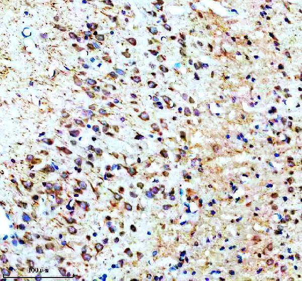IHC analysis of Synaptotagmin-10/SYT10 using anti-Synaptotagmin-10/SYT10 antibody (A14108-2)