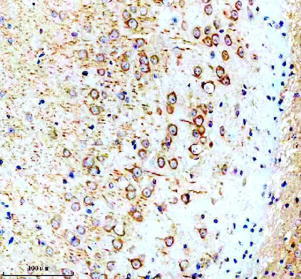 a14108 2 syt10 primary antibodies ihc testing 3