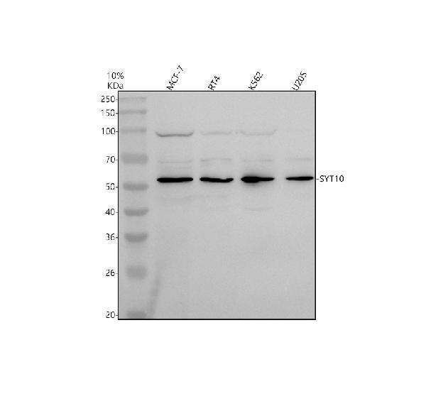 Western blot analysis of Synaptotagmin-10/SYT10 using anti-Synaptotagmin-10/SYT10 antibody (A14108-2)