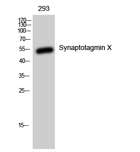 Western blotting validation for Anti-Synaptotagmin X SYT10 Antibody A14108
Western Blot (WB) analysis of 293 cells using Synaptotagmin X polyclonal antibody