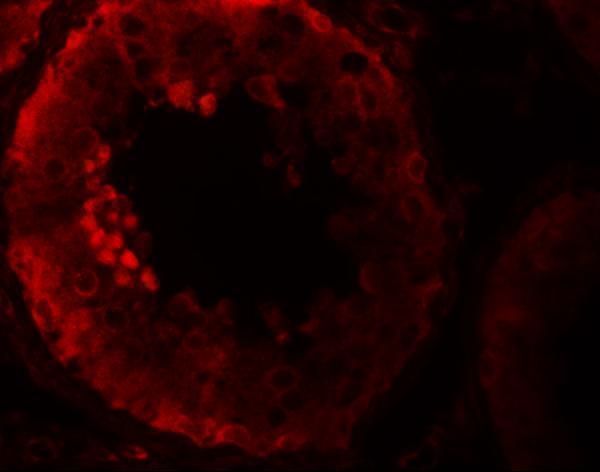 Immunofluorescence of NOD6 in human testis tissue with NOD6 antibody at 20 μg/mL