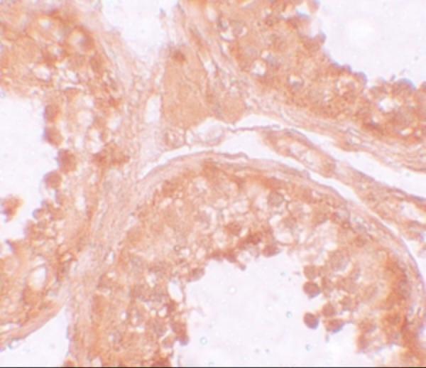 Immunohistochemistry of NOD6 in human testis tissue with NOD6 antibody at 10 μg/mL