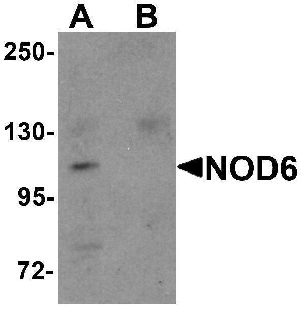 Western blot analysis of NOD6 in EL4 cell lysate with NOD6 antibody at 1 μg/mL in the (A) absence and (B) presence of blocking peptide
