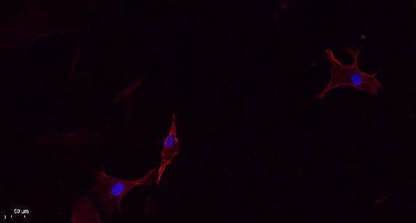 a14124 cmtm4 primary antibodies if testing 1