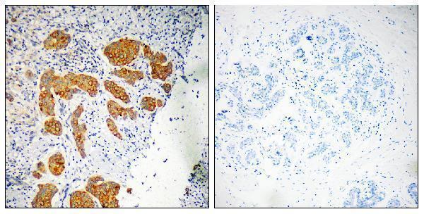 a14124 cmtm4 primary antibodies ihc testing 4