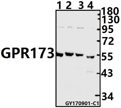 Western blot (WB) analysis of GPR173 (Y289) pAb at 1:1000 dilution
Lane1:BV2 whole cell lysate(20ug)
Lane2:C6 whole cell lysate(20ug)
Lane3:Hela whole cell lysate(20ug)
Lane4:SK-OVCAR3 whole cell lysate(20ug)