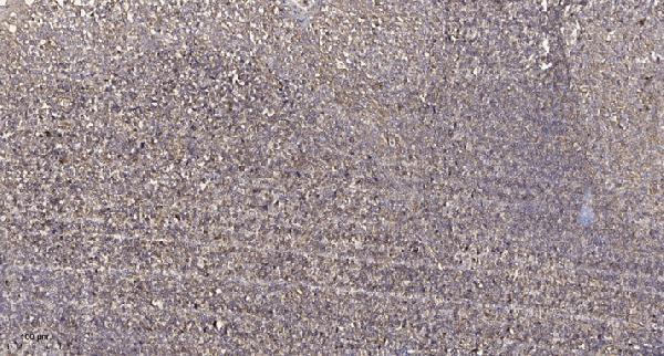 a14133 1 pfdn1 primary antibodies ihc testing 1