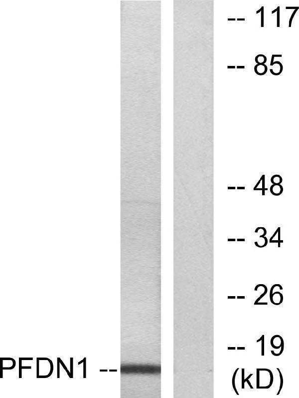 a14133 1 pfdn1 primary antibodies wb testing 2