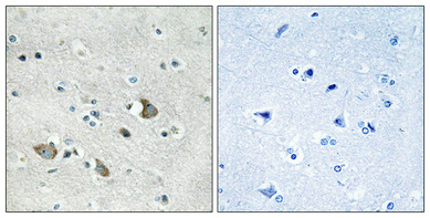 a14134 2 mrpl32 primary antibodyes ihc testing 1